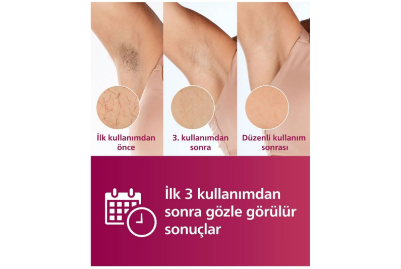 Philips BRI950/00 Lumea Prestige IPL Epilasyon Aleti - 2