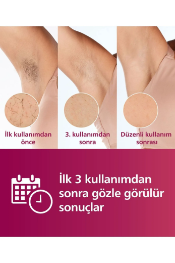 Philips BRI950/00 Lumea Prestige IPL Epilasyon Aleti - Thumbnail