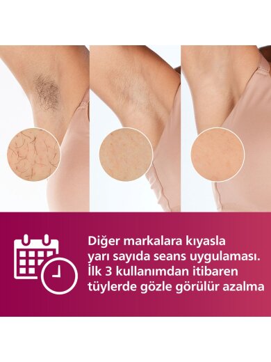 Philips SC1997/00 Lumea Advanced IPL Epilasyon Aleti - 2