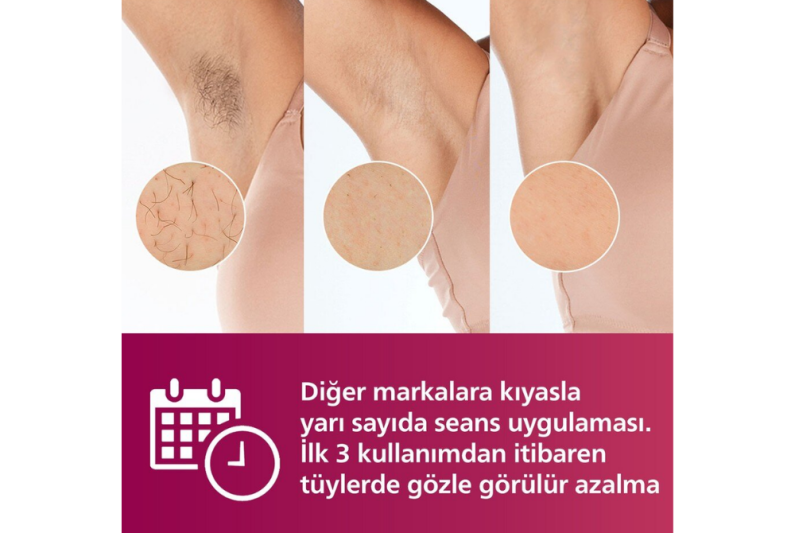 Philips SC1997/00 Lumea Advanced IPL Epilasyon Aleti - 2